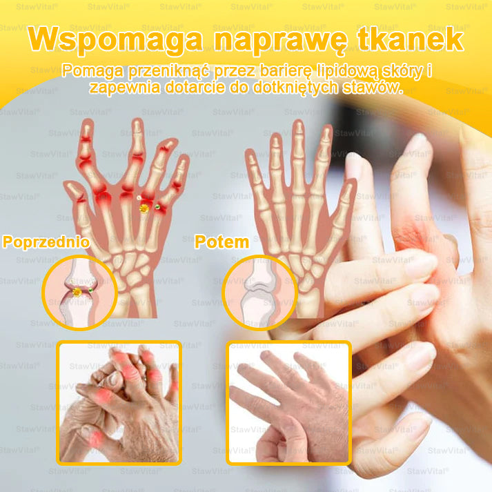 ✅ BSWELL® Krem z jadem pszczelim na regenerację stawów 🏃‍♀️ (ekstrakt z pszczoły nowozelandzkiej – opracowany z myślą o osobach z problemami ze stawami i bólem stawów)