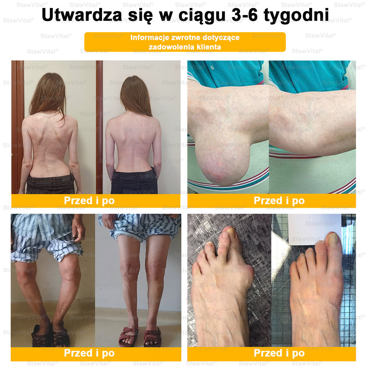 ✅ BSWELL® Krem z jadem pszczelim na regenerację stawów 🏃‍♀️ (ekstrakt z pszczoły nowozelandzkiej – opracowany z myślą o osobach z problemami ze stawami i bólem stawów)