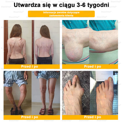 ✅ BSWELL® Krem z jadem pszczelim na regenerację stawów 🏃‍♀️ (ekstrakt z pszczoły nowozelandzkiej – opracowany z myślą o osobach z problemami ze stawami i bólem stawów)
