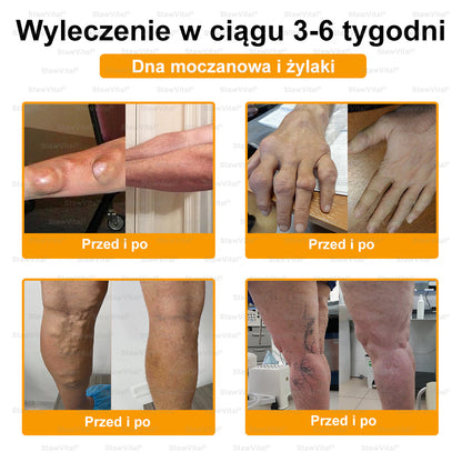 ✅ BSWELL® Krem z jadem pszczelim na regenerację stawów 🏃‍♀️ (ekstrakt z pszczoły nowozelandzkiej – opracowany z myślą o osobach z problemami ze stawami i bólem stawów)