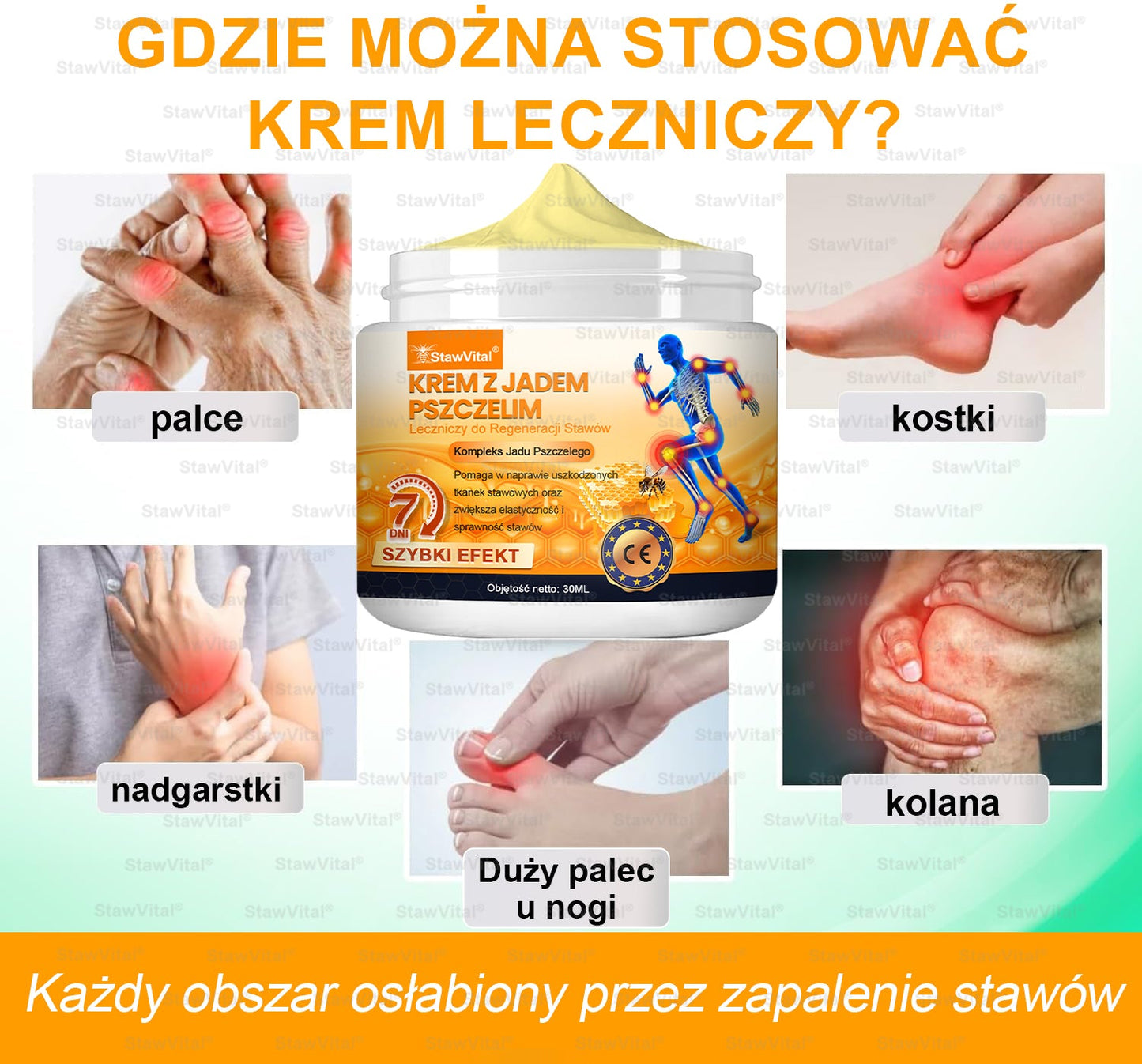 💚𝑺𝒕𝒂𝒘𝑽𝒊𝒕𝒂𝒍® Krem z jadem pszczelim na regenerację stawów 🏃‍♀️ (ekstrakt z pszczoły nowozelandzkiej – opracowany z myślą o osobach z problemami ze stawami i bólem stawów)