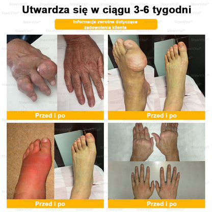 ✅ BSWELL® Krem z jadem pszczelim na regenerację stawów 🏃‍♀️ (ekstrakt z pszczoły nowozelandzkiej – opracowany z myślą o osobach z problemami ze stawami i bólem stawów)