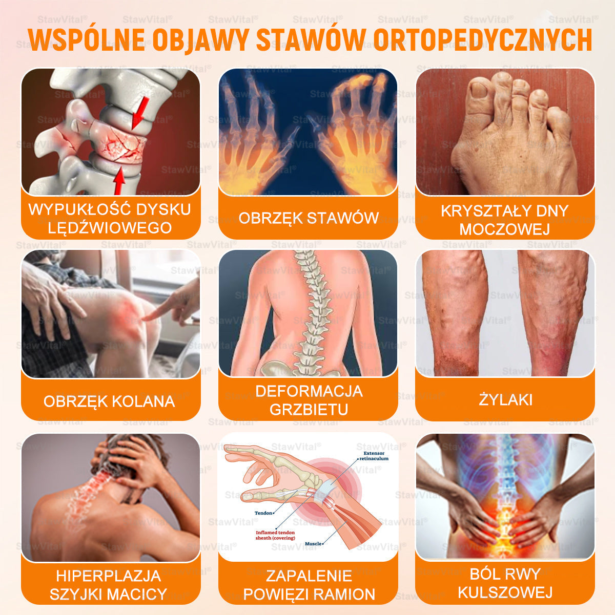 ✅ BSWELL® Krem z jadem pszczelim na regenerację stawów 🏃‍♀️ (ekstrakt z pszczoły nowozelandzkiej – opracowany z myślą o osobach z problemami ze stawami i bólem stawów)