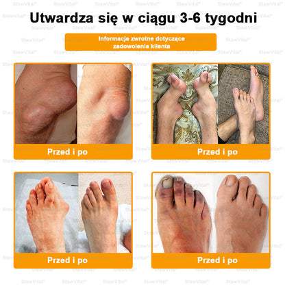 ✅ BSWELL® Krem z jadem pszczelim na regenerację stawów 🏃‍♀️ (ekstrakt z pszczoły nowozelandzkiej – opracowany z myślą o osobach z problemami ze stawami i bólem stawów)