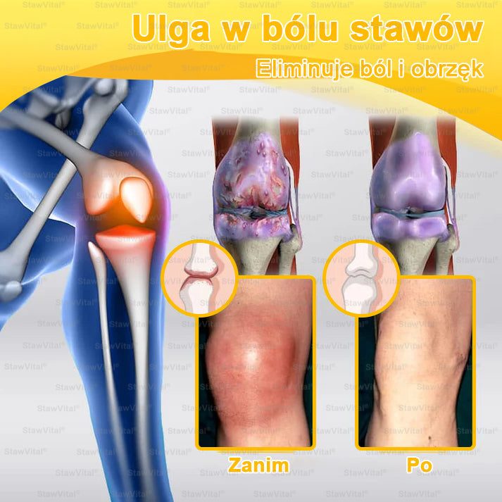 ✅ BSWELL® Krem z jadem pszczelim na regenerację stawów 🏃‍♀️ (ekstrakt z pszczoły nowozelandzkiej – opracowany z myślą o osobach z problemami ze stawami i bólem stawów)