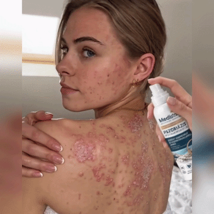 Medistart® Specjalistyczna Pielęgnacja Skóry z Łuszczycą